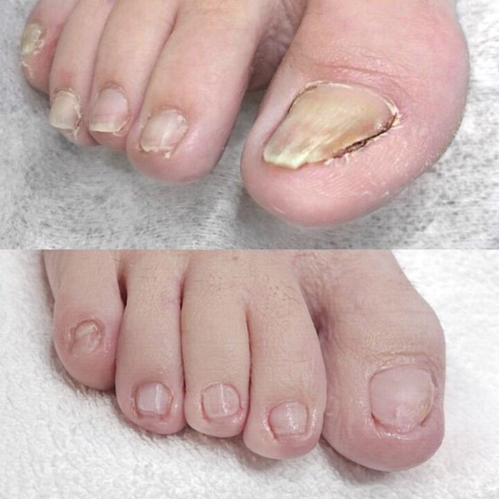 Σχόλια σχετικά με τη χρήση της κεραμίνης